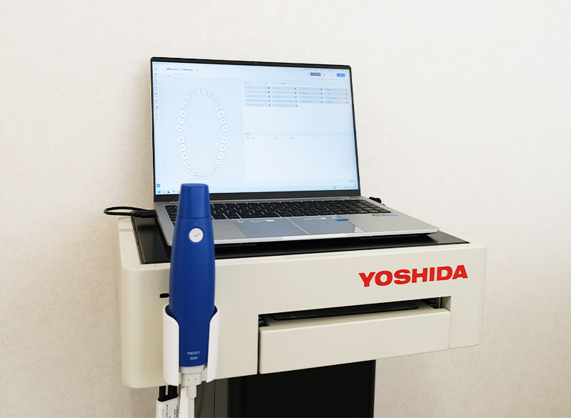 口腔内3Dスキャナー