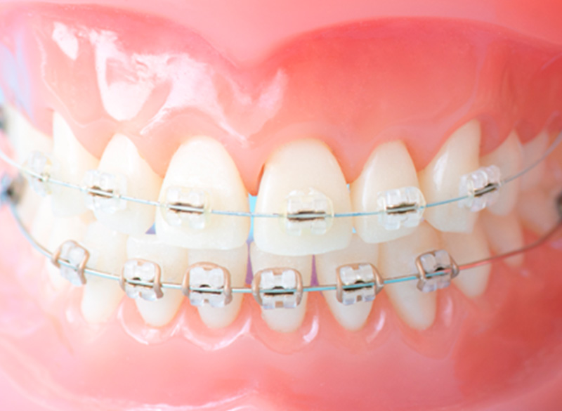 矯正歯科・小児矯正歯科